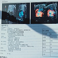 这四维看不清啊   哈哈  你们的四维怎么都那么清楚呢  看单子能看出是男孩女孩吗  好奇  嘻嘻