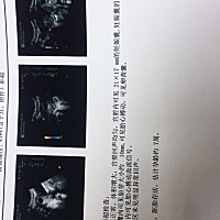 昨天晚上流血了去医院检查医生说没什么，拿了点保胎药说让我休息一个星期，本来打算今天去上班的看到还...