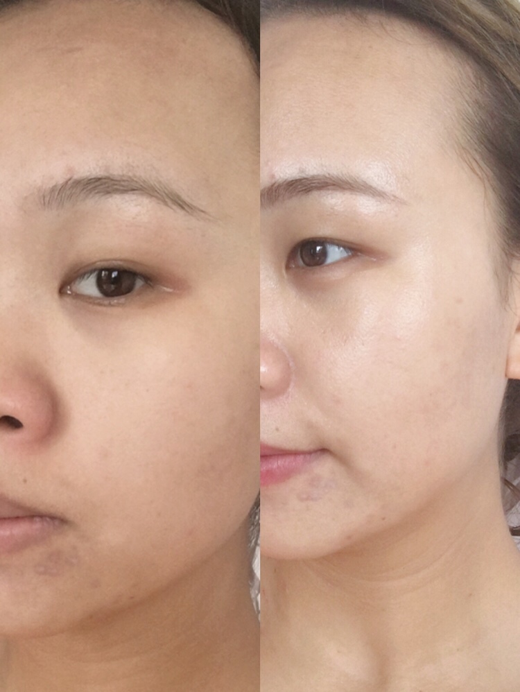 左图纯素颜，右图图了素颜霜之后的效果