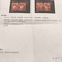 请问有没有看懂的 月经17号来的 今天去检查排卵 卵泡小 我现在是11✖️11医生给我推算现在应该卵泡发育1...