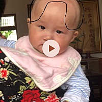 娃额头好像有一圈突出的，是啥情况啊？