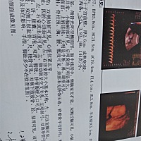 谁能告诉我是男孩是女孩啊？
