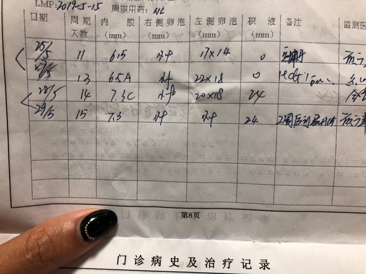 看图28号中午检查卵子还在 下午两点同房。29号早上10点去医院检测卵子不再了 这样怀孕机遇大？？帮看看啊