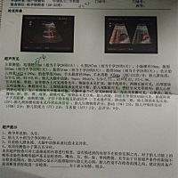 昨天检查，说宝宝变小两周，双顶径，头都偏小，今天换个医院检查，头还是偏小两周，建议做羊水穿刺4...