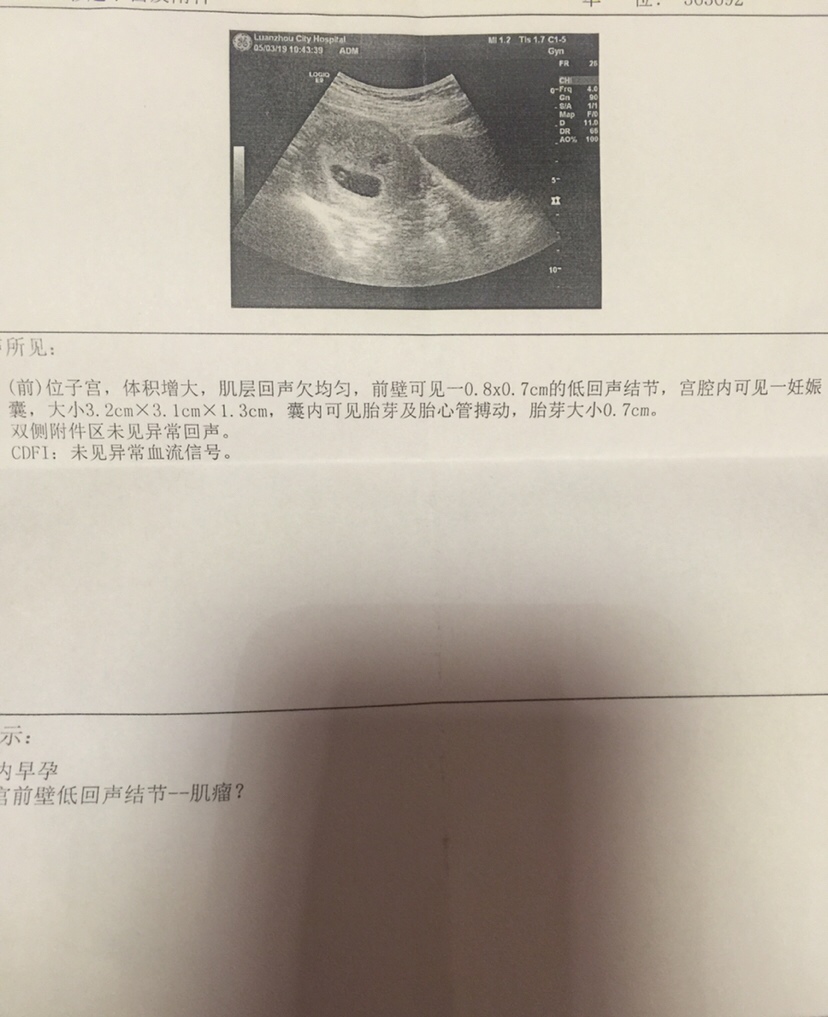 猜男女游戏开始了，纯属娱乐好奇…