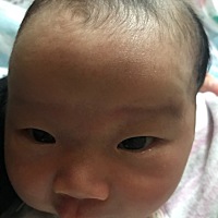 有没有宝宝前额头长旋的！