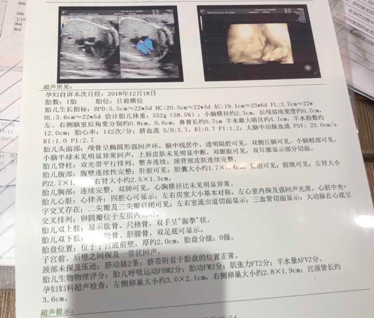 宝妈们
谁会看 这是王子还是公主呢  求公主一枚😄