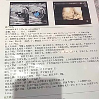 宝妈们 谁会看 这是王子还是公主呢  求公主一枚😄