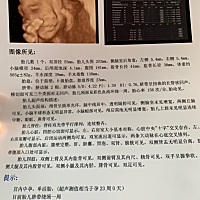 四维通过😄辣妈们猜猜男孩👦女孩👧