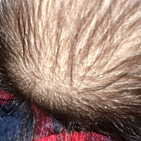 万能的育儿圈，宝宝两个月大，头皮很干像头皮屑一样的，是怎么回事？需要涂什么药吗？