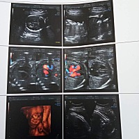 求助，是男孩还是女孩？