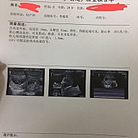 请问，这个男宝还是女宝。