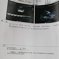 会不会怀的太低了，需要注意什么吗？