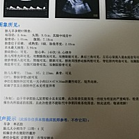 这能看出是男宝女宝嘛