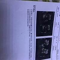 🙏据说孕囊数据大小可以看男女😘，姐妹们，帮忙看看是男是女