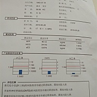 亲们跟我看哈是女孩还是男孩，我是二胎，剖腹产。
