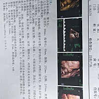 有没有会看四维图的？求告诉 宝宝什么情况？