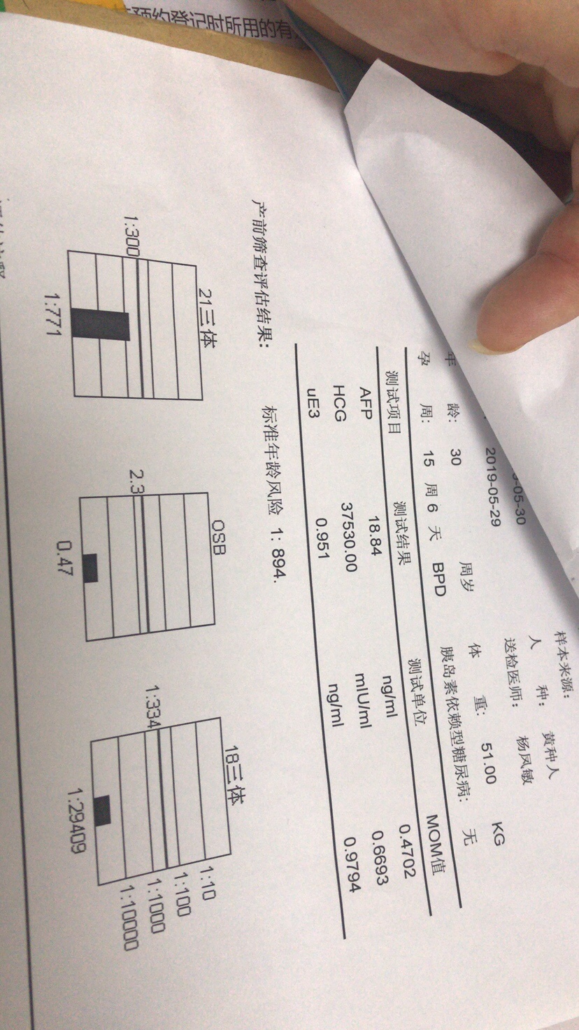 这是唐筛没过结果，希望谁能告诉我不是那样的jie gt