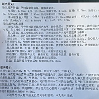 各位宝妈，能帮我看下是男宝女宝吗？