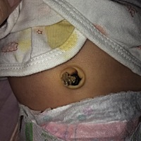 18天了，肚脐还没掉，有同款宝贝吗