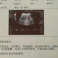 孕囊看男女？谁懂？ 谁会看？男女？勿喷，谢谢。