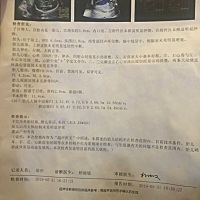 为什么 别人照的都有脸什么的，我就是这样子，也没说四肢情况。什么意思啊？就这还700块呢