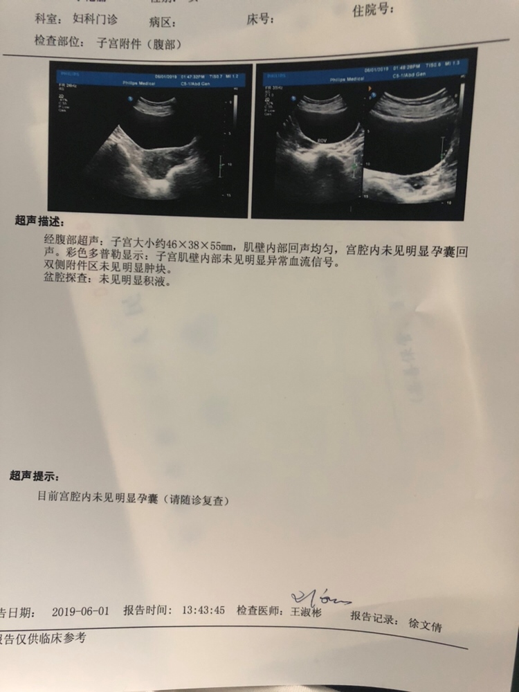 最后一次月经是4月23号 ， 自己测了是怀孕B超做不出来 ， 好怕是怀个假孕