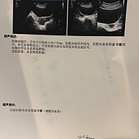 最后一次月经是4月23号 ， 自己测了是怀孕B超做不出来 ， 好怕是怀个假孕