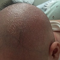 宝宝这头上长的啥