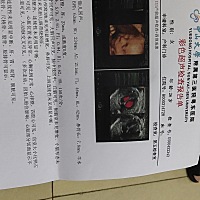 为什么我感觉你们的四维都好模糊啊  我照的很清晰啊