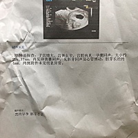 姐妹们 你们能不能帮忙看看 现在能不能看出来是男孩还是女孩呢？非常感谢🙏