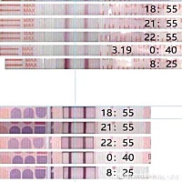 8年连续生了6个女儿的小姐姐 才26岁，她找到我们，很迷茫， 认为自己没有婆婆命，从结婚一直生， 一直都...