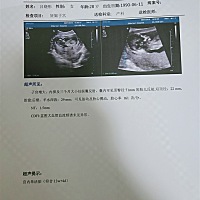 各位老师，麻烦大家帮我看一下，这个能看出男孩女孩吗？大宝女宝，想凑个好，两个女宝也不错。