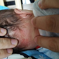 宝宝25天，生下来发现脖子上有一些红色，是不是胎记，宝妈们有同样的吗？