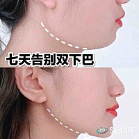五个瘦脸动作 七天告别双下巴   上篇出了瘦咬肌的动作，有很多宝宝们私信问有没有去除双下巴、消除脸部...