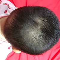 我妈说这种双旋的人脾气最坏！牛脾气牛投胎