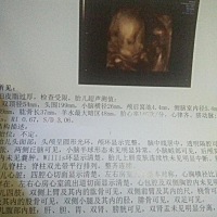 好奇是乔治还是佩奇大家帮忙看看，满足下好奇心