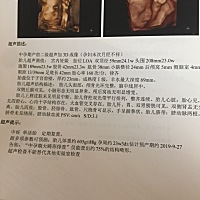 今天刚做的四维，好奇，大家帮忙看下男宝女宝……