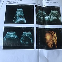 帮忙看看男孩女孩谢谢