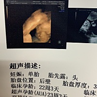 求大神指点是男宝女宝