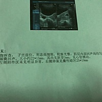 意外有了二胎，希望是个女孩👧