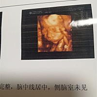 今天做了三维，宝宝很健康，就是有点调皮很好动呀。听说是爸爸的小情人，宝爸开心坏了。