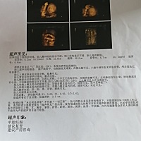 四维不错，有一项三尖瓣可见少于反流信号，医生说一般都没有问题，不放心的可以去大医院查一下，有没有...
