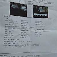 亲们看看是男孩还是女孩呢？