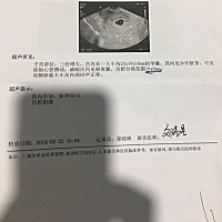 有人会看男孩女孩吗