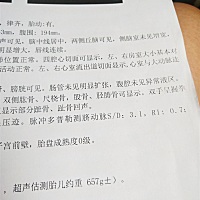 帮忙看看这个有多重啊