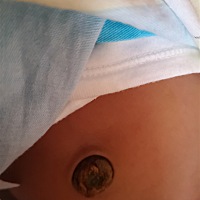 今天23天了，宝宝的肚脐还没脱落，请问各位宝妈正常吗？