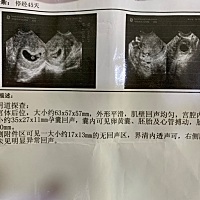 会看男孩女孩的朋友们来发表一下观点