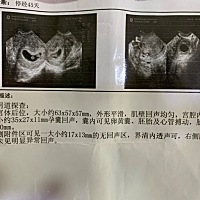 姐妹们来帮我看下男孩女孩吧.