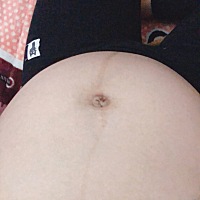 肚子上的线是歪的，啥情况？鼓包也是右边多，是不是小佩奇啊？